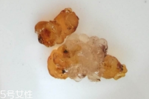 桃膠可以用開水泡嗎？用開水泡桃膠好嗎？