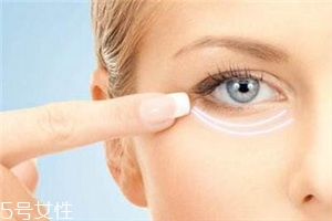嗨體可以打淚溝嗎？嗨體填充淚溝注意事項
