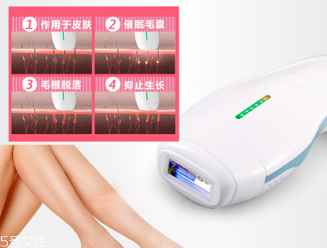 deess脫毛儀多少錢(qián)？蒂絲脫毛儀價(jià)格
