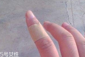 創(chuàng)可貼可以消腫嗎？創(chuàng)可貼有消腫功效嗎？