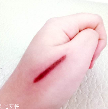 創(chuàng)可貼和肉連著怎么辦？創(chuàng)可貼連著肉怎么處理？