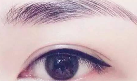 提眉和雙眼皮一起做嗎？提眉和雙眼皮要隔開多久
