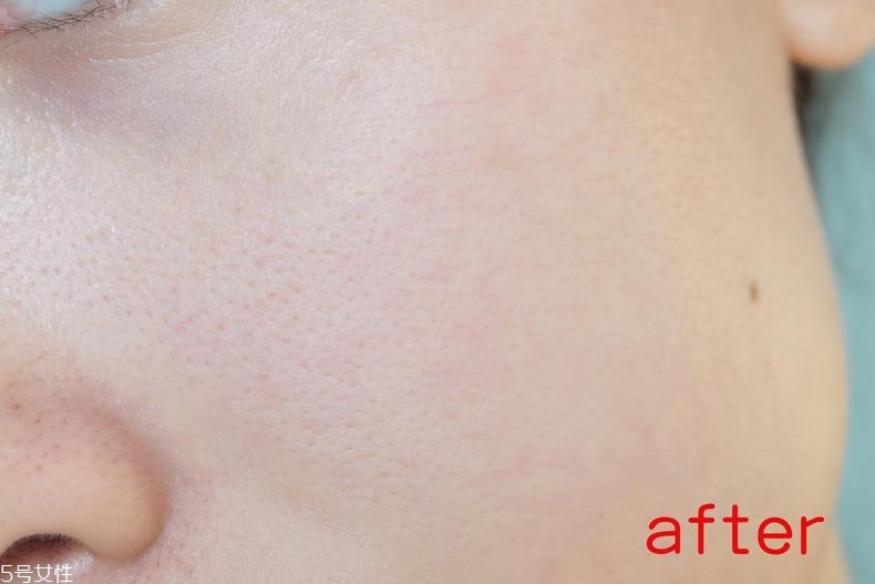radha beauty vc精華白天能用嗎？敏感肌能用嗎？