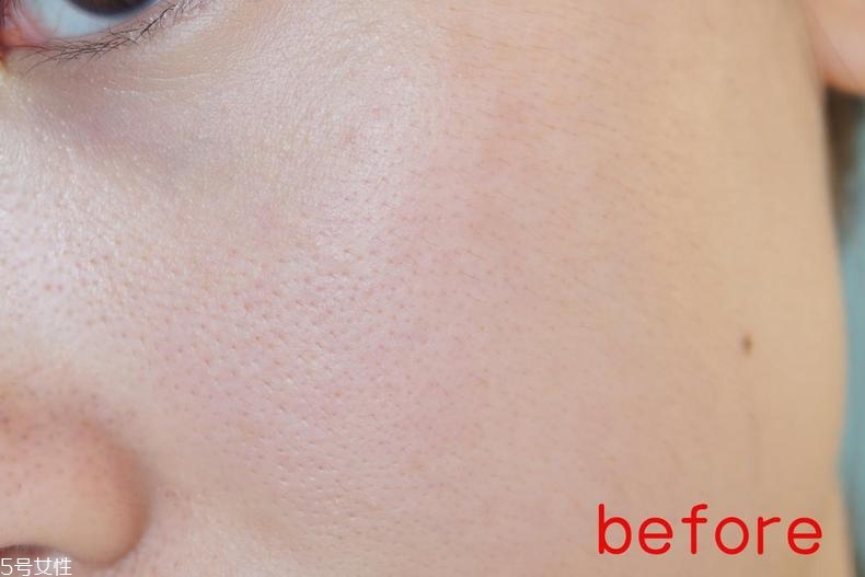radha beauty vc精華白天能用嗎？敏感肌能用嗎？