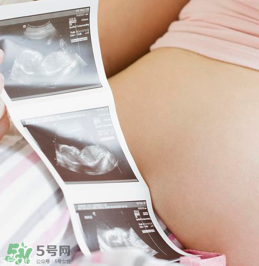 頭胎雙胞胎還能生二胎嗎？雙胞胎家庭能要二胎嗎？