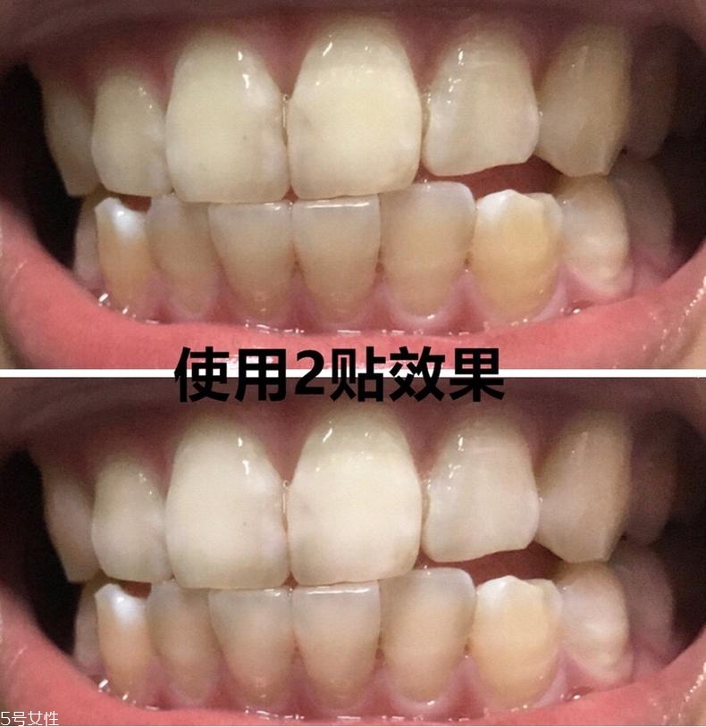 佳潔士美白牙貼貼多久有效？佳潔士美白牙貼使用感受