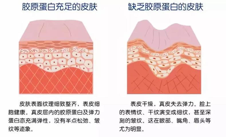 法令紋明顯什么原因 6個(gè)原因讓你少年老成