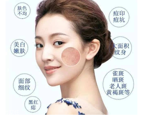 皮秒會反黑嗎 這是正?，F(xiàn)象