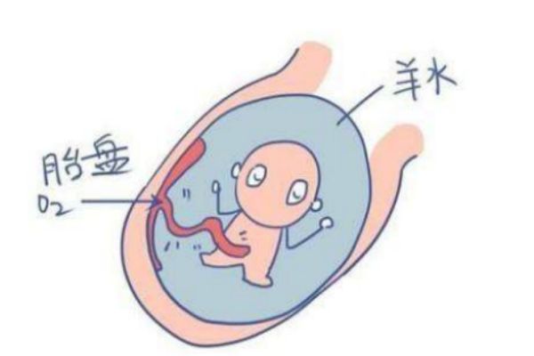 孕婦羊水過(guò)多什么癥狀 媽媽們要注意