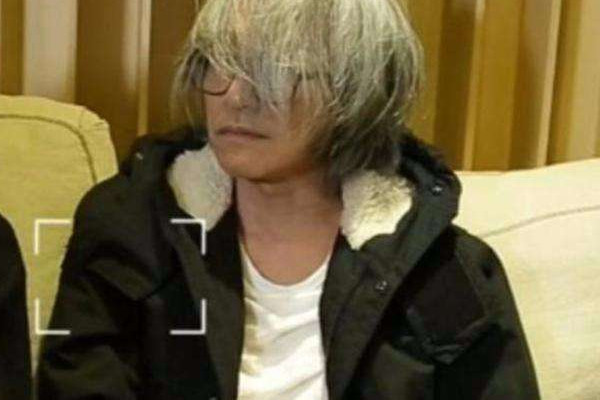 白頭發(fā)可以洗黑嗎 白頭的形成