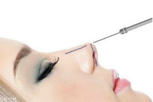 硅膠隆鼻取出多久消腫 鼻子硅膠取出親身經歷
