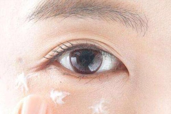眼部皮膚過(guò)敏怎么辦 眼部皮膚過(guò)敏的表現(xiàn)