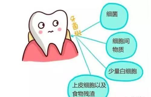 飯后多久用簌口水適合 牙結(jié)石會(huì)自己掉嗎
