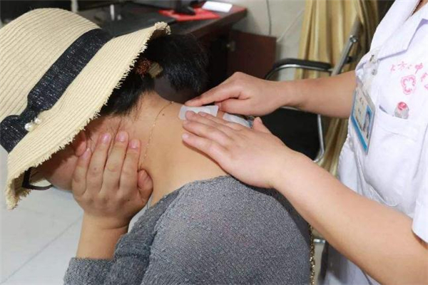 三伏貼一次貼幾張 貼三伏貼要忌口多長時間