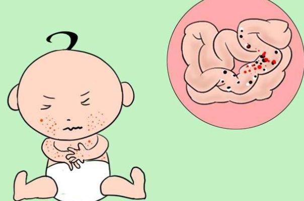 孩子過(guò)敏為什么眼睛腫 寶寶過(guò)敏眼睛腫了怎么消腫