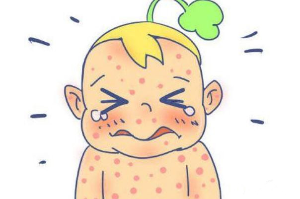 孩子過敏要去醫(yī)院?jiǎn)?孩子過敏要吃什么藥