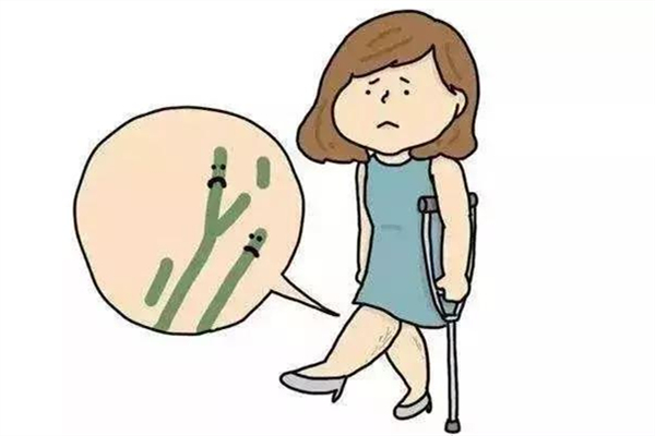 靜脈曲張會死人嗎 靜脈曲張用什么辦法治療最好