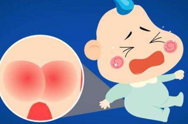 尿布疹是什么原因引起的 尿布疹是過(guò)敏嗎