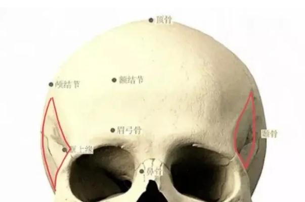 顴骨內推是永久的嗎 顴骨內推要打鈦釘嗎