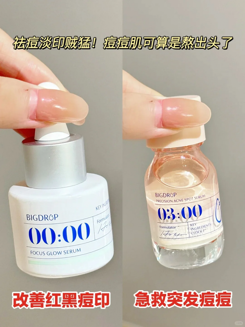 祛痘產(chǎn)品橫測(cè)：谷雨白千祛痘凝膠、大水滴與達(dá)爾膚杏仁酸，誰(shuí)是祛痘王者？